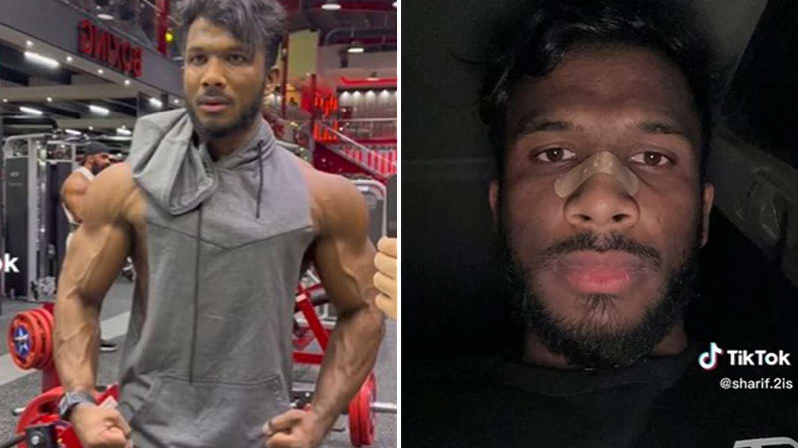TikToker breaks nose after passing out at gym from flexing too hard
