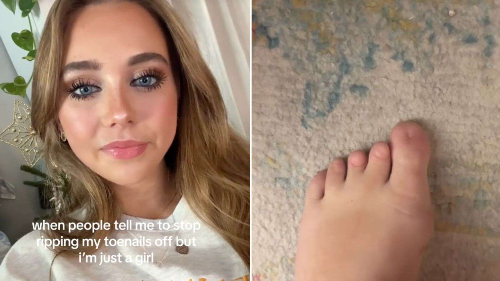 TikToker goes viral for being born without toenails