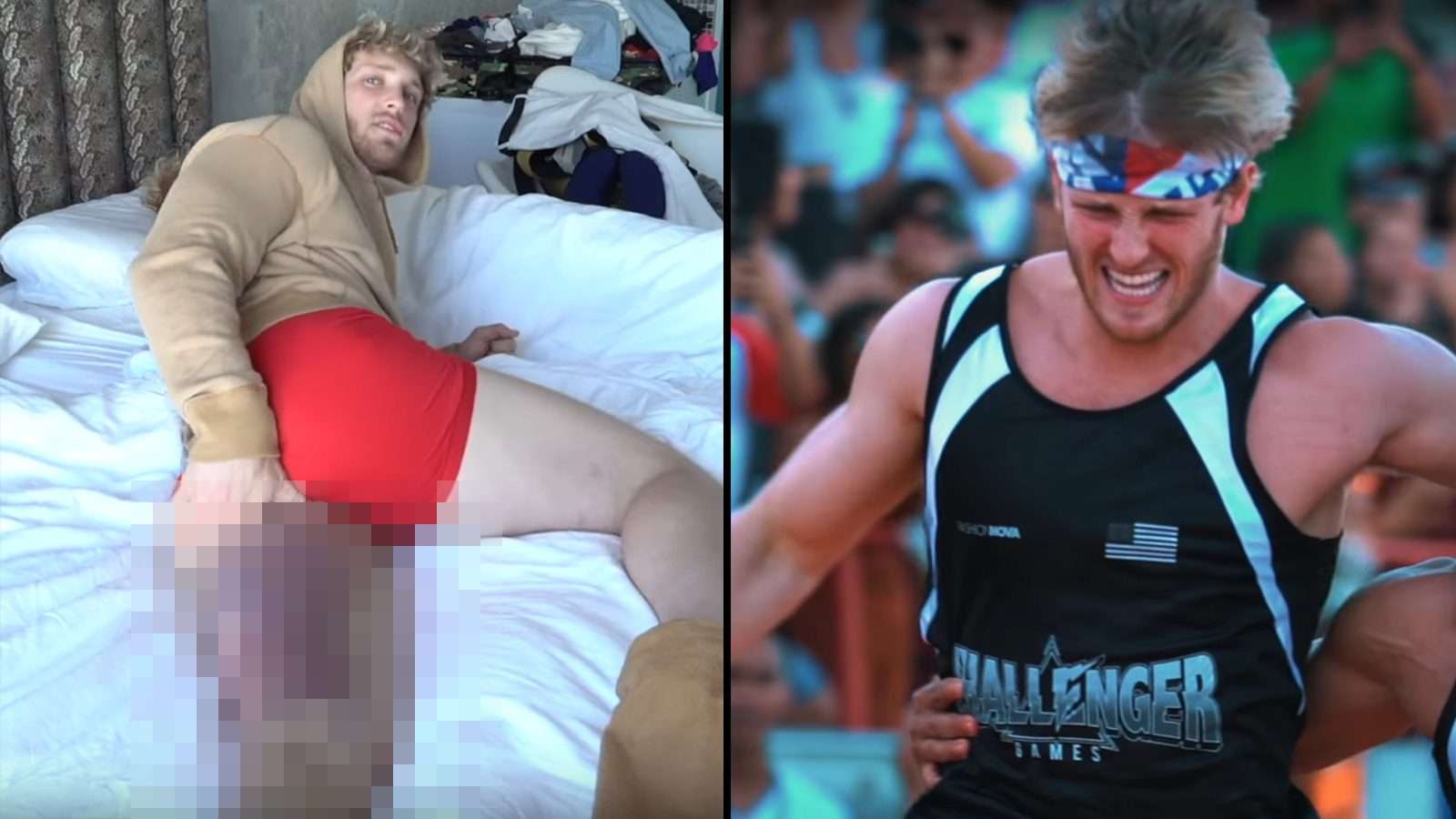 Logan Paul shares update on gruesome leg injury suffered at Challenger Games  - Dexerto