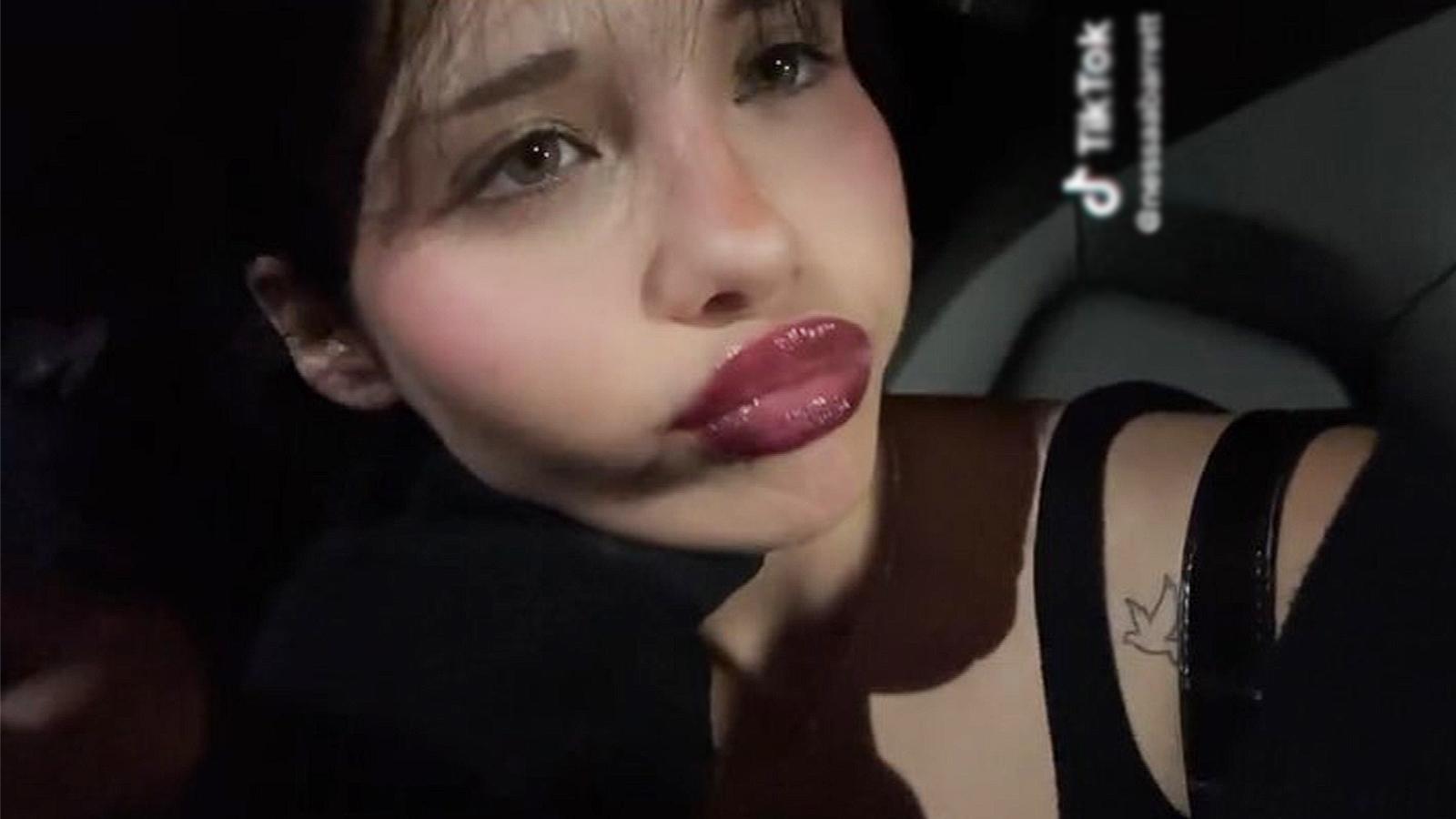 Fans divided over Nessa Barrett's new lip look