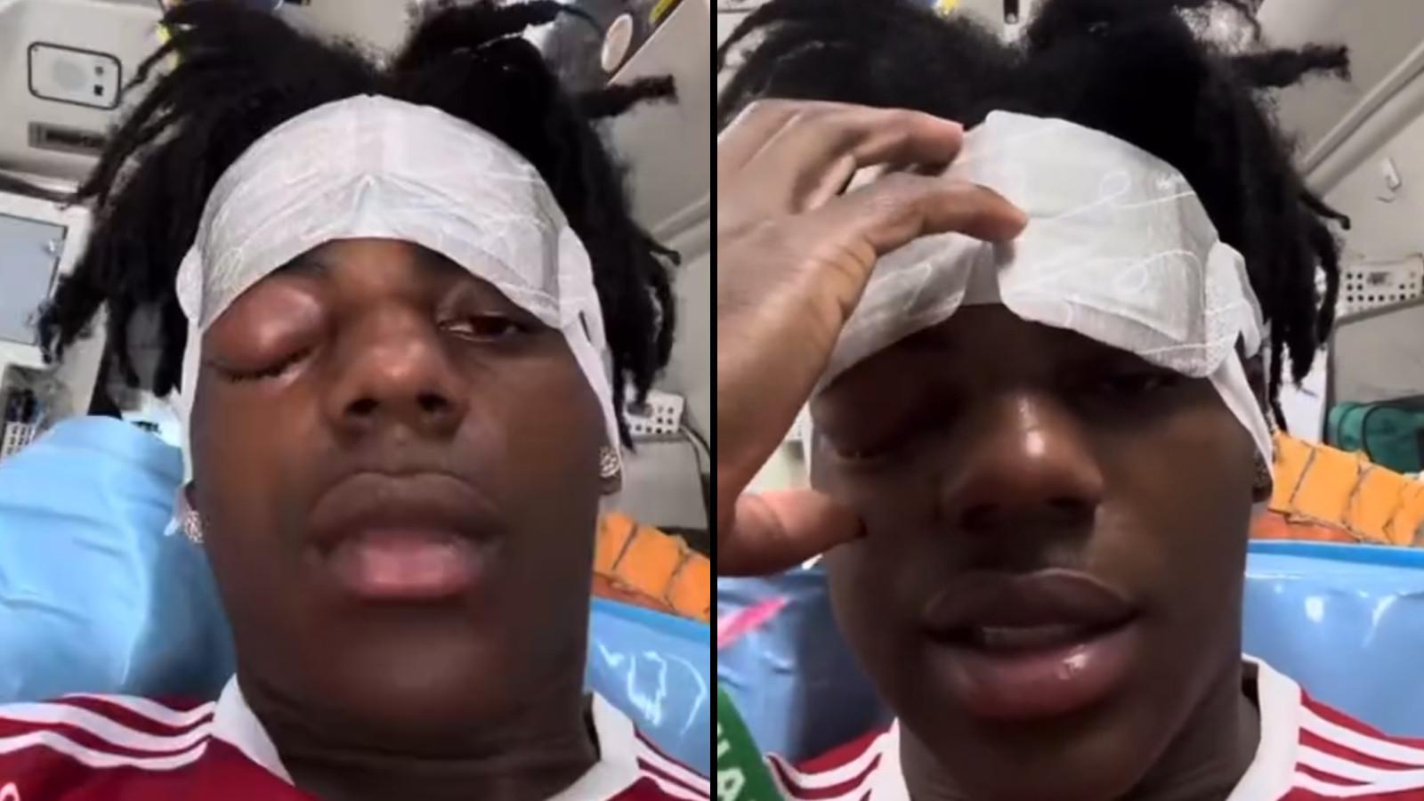 Is IShowSpeed okay? Streamer undergoes emergency surgery in hospital for  swollen eye