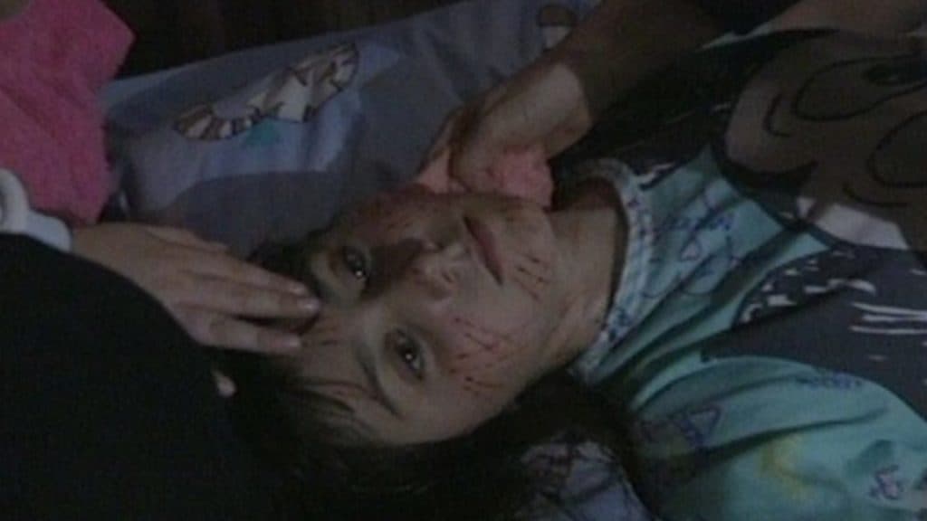 young girl covered in scratches from the film Ghostwatch